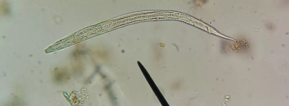 Wurmbefall unter dem Mikroskop dargestellt